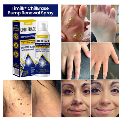 Timilk® ChillErase Bump Renewal Spray!
