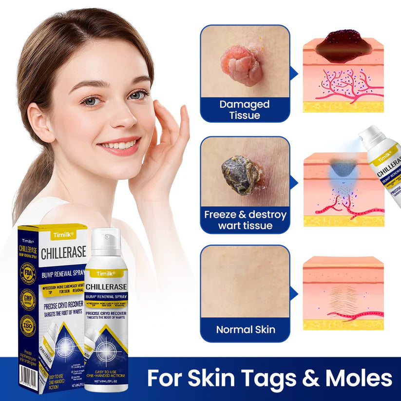 Timilk® ChillErase Bump Renewal Spray!