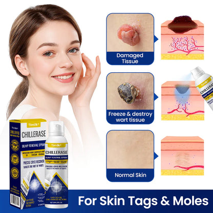 Timilk® ChillErase Bump Renewal Spray!