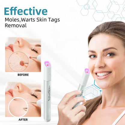 ✨VelvetSkin+™ All-in-One CO₂ Laser Eraser Pen | Removes Moles, Warts, Skin Flaws & Pigmentation
